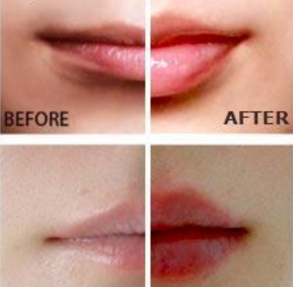 Miracle Lip Plumper gloss black